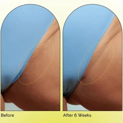 New Fur Ingrown Concentrate