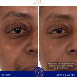 Best Augustinus Bader The Eye Patches